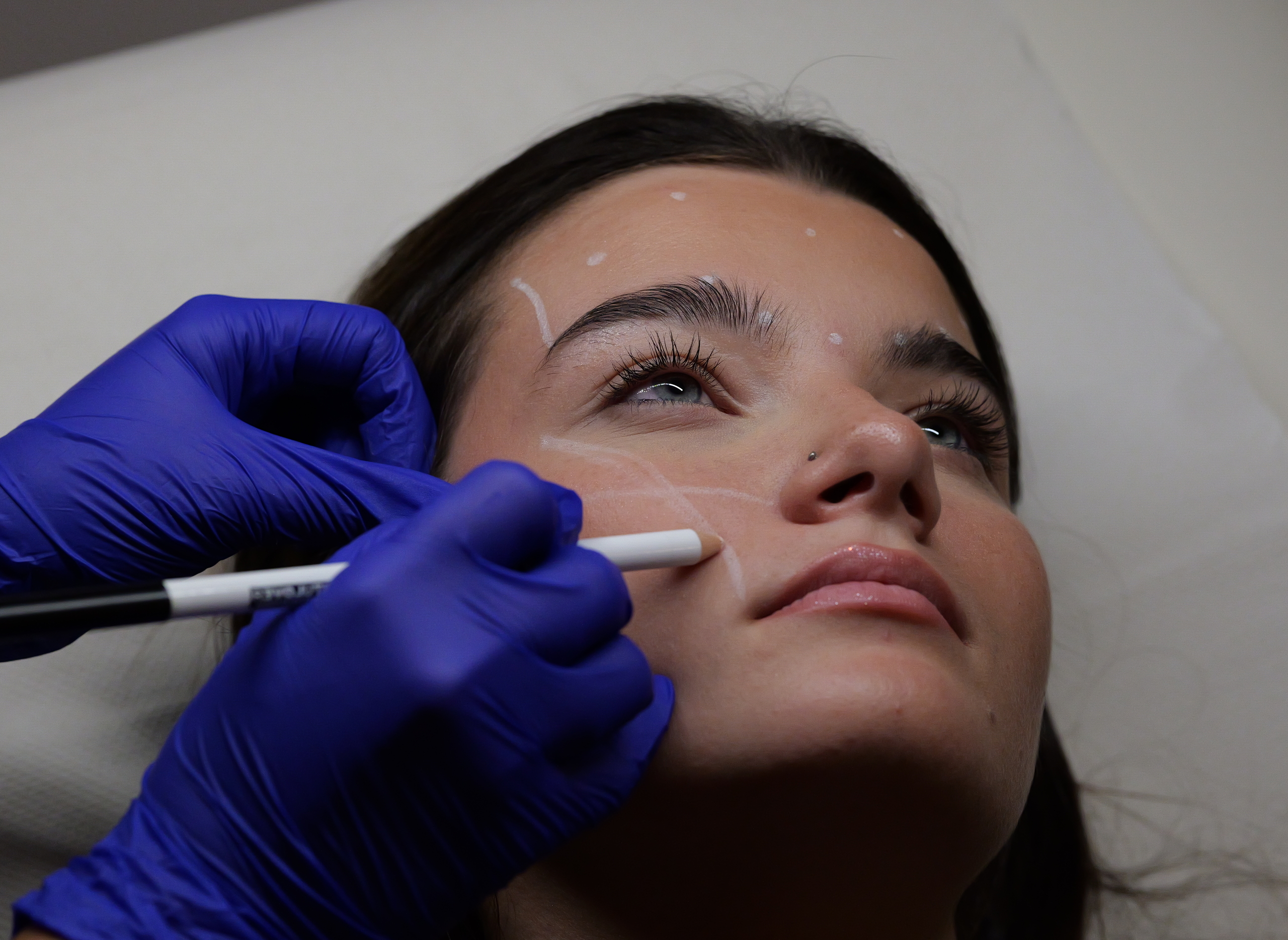 antiwrinkle drc treats patient eight