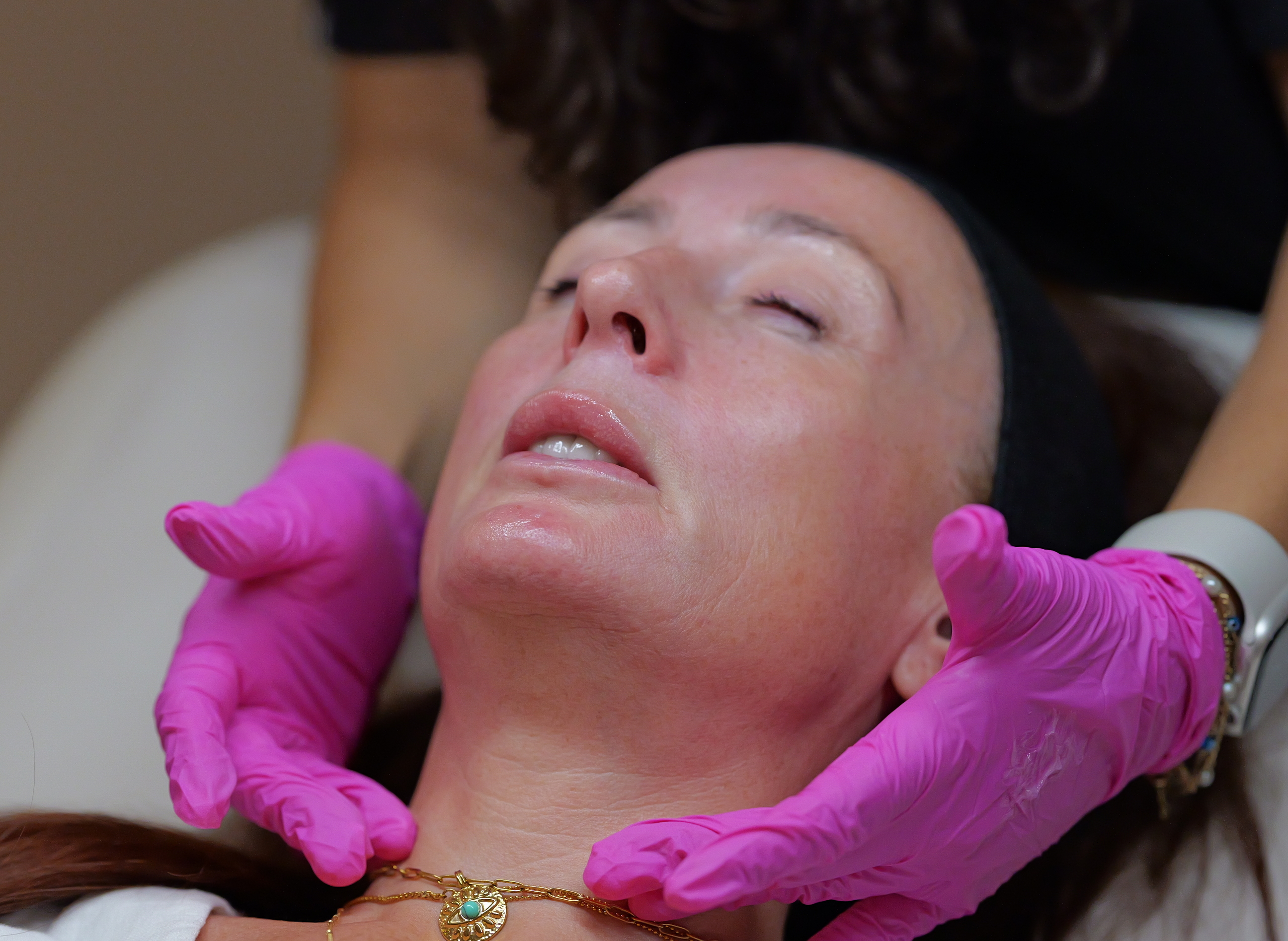 chemical peels drc treats patient eleven