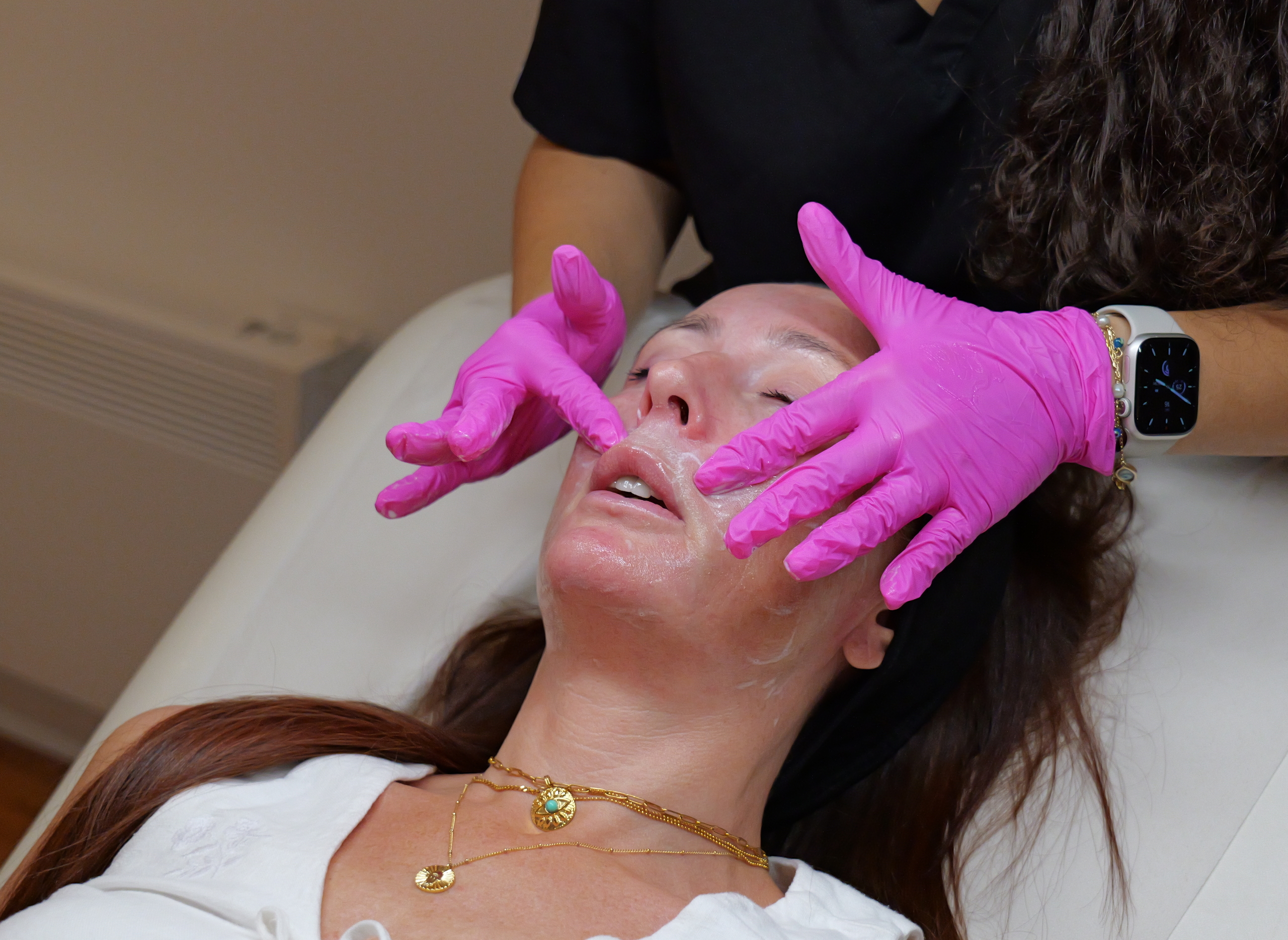 chemical peels drc treats patient thirteen