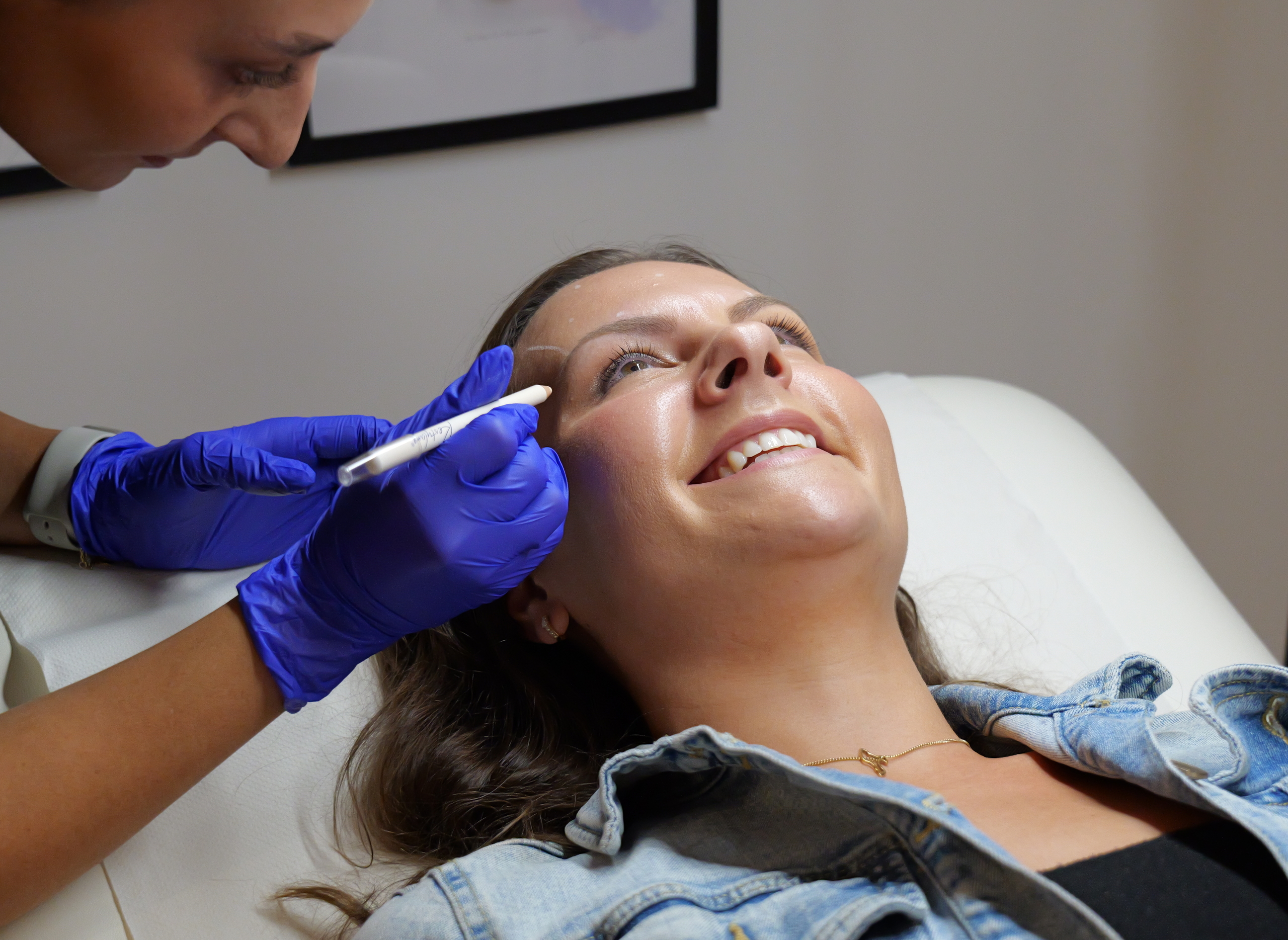 dermal fillers drc treats patient three