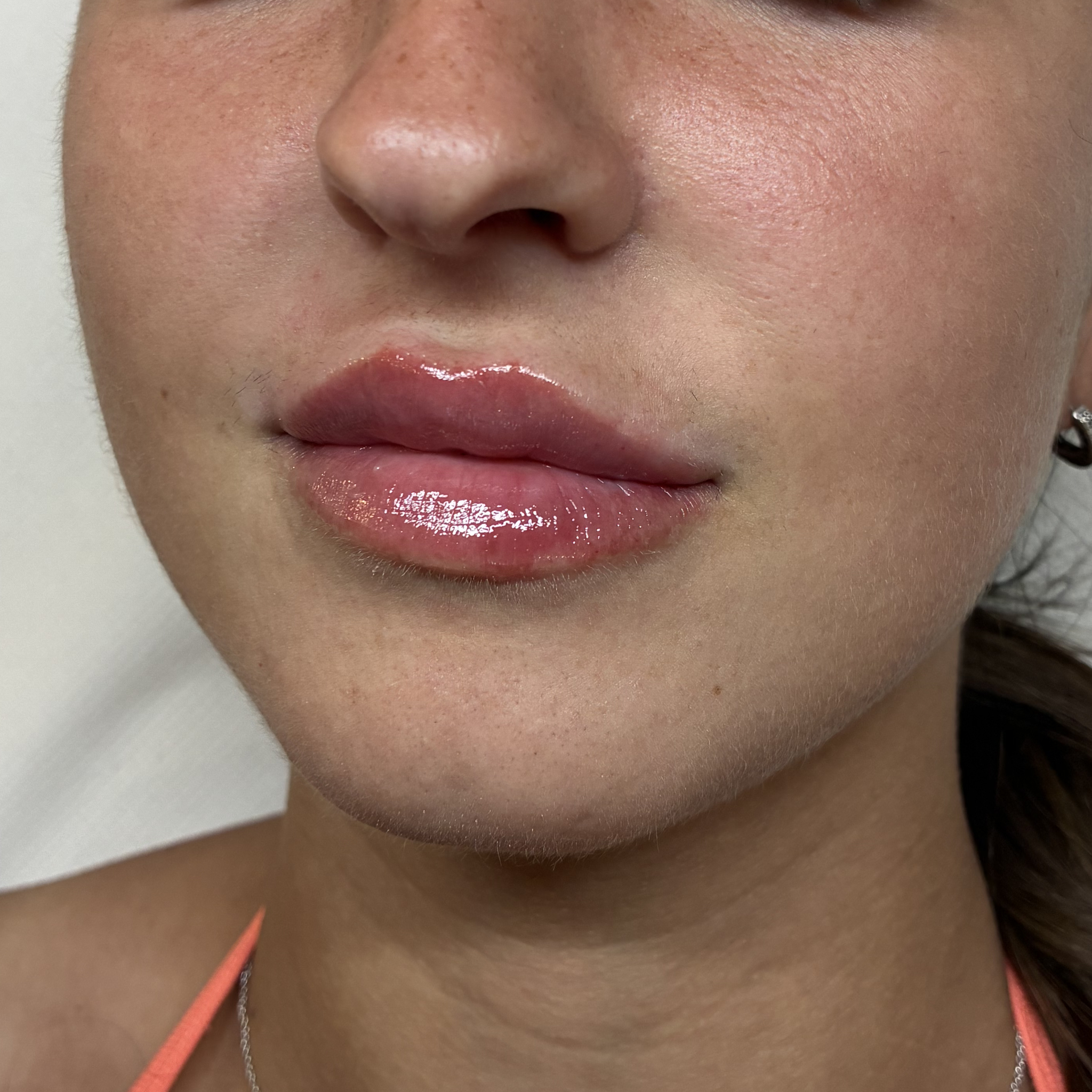 lips eight left after