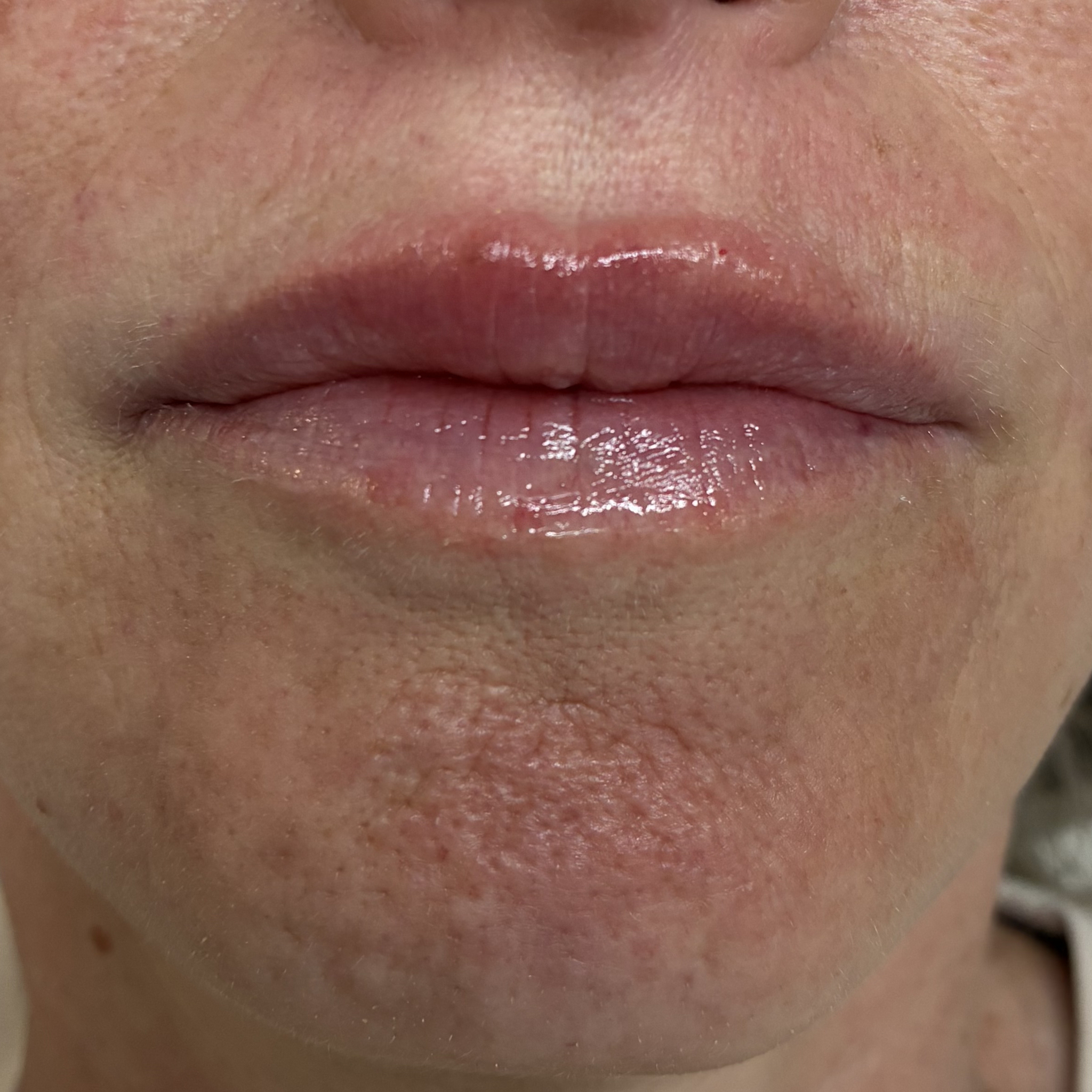 lips eleven front after