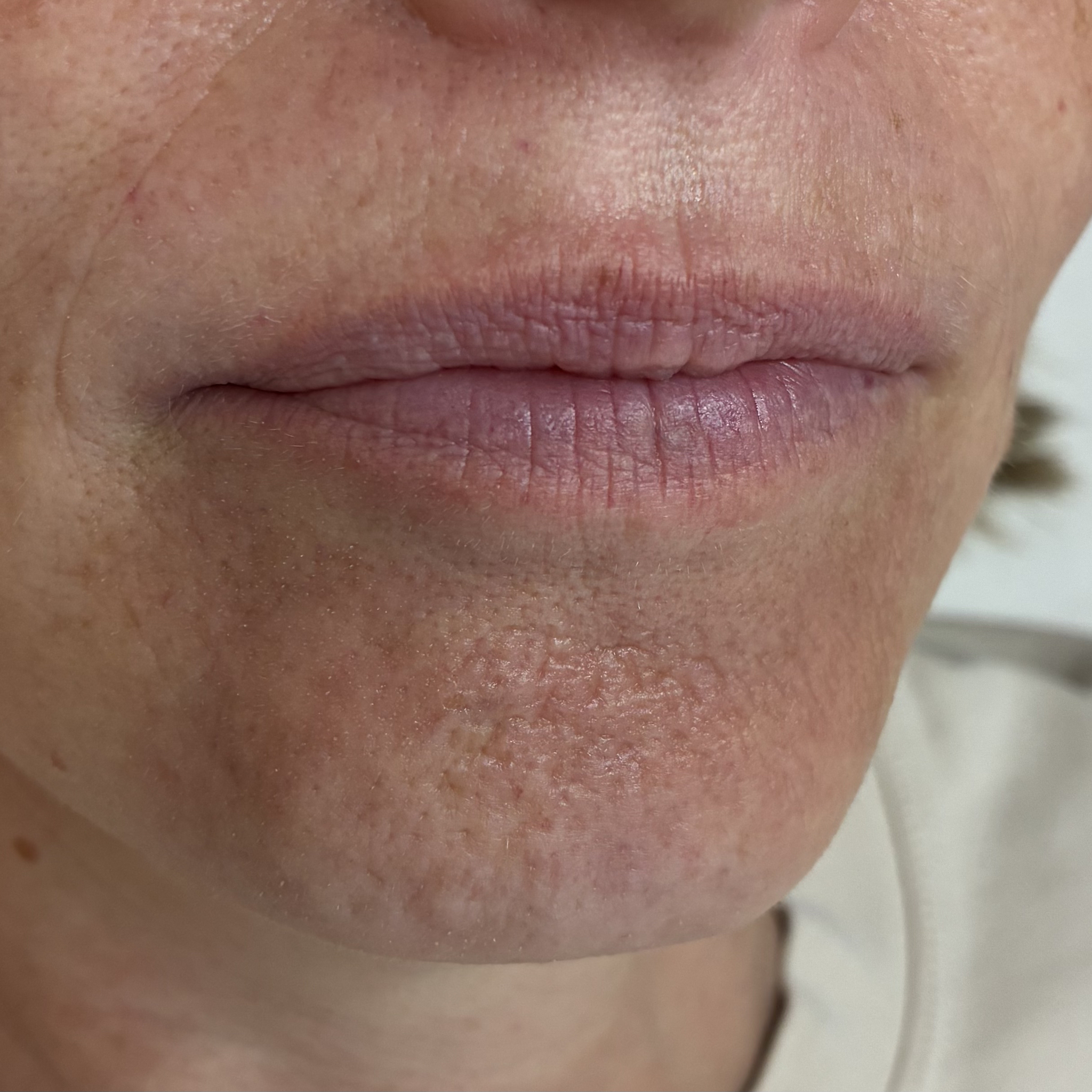 lips eleven right before