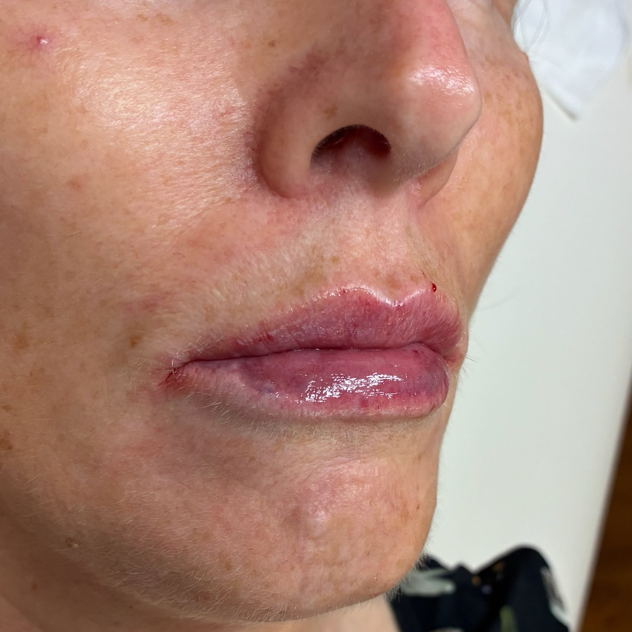 lips seven right after