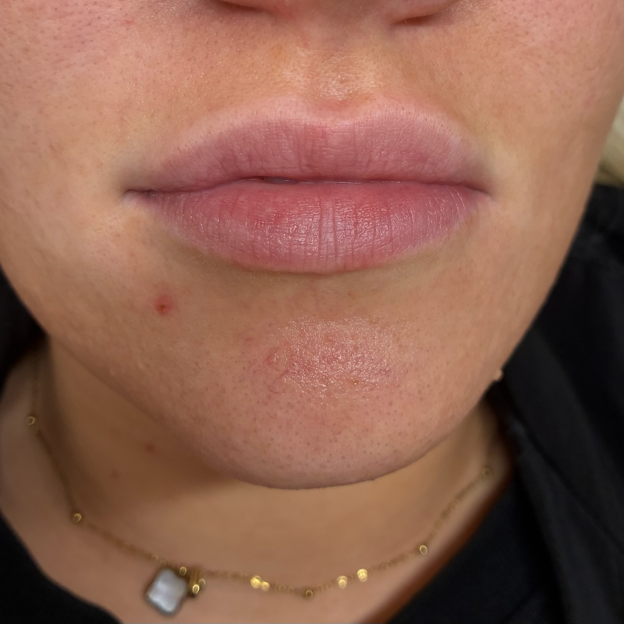 lips six front before