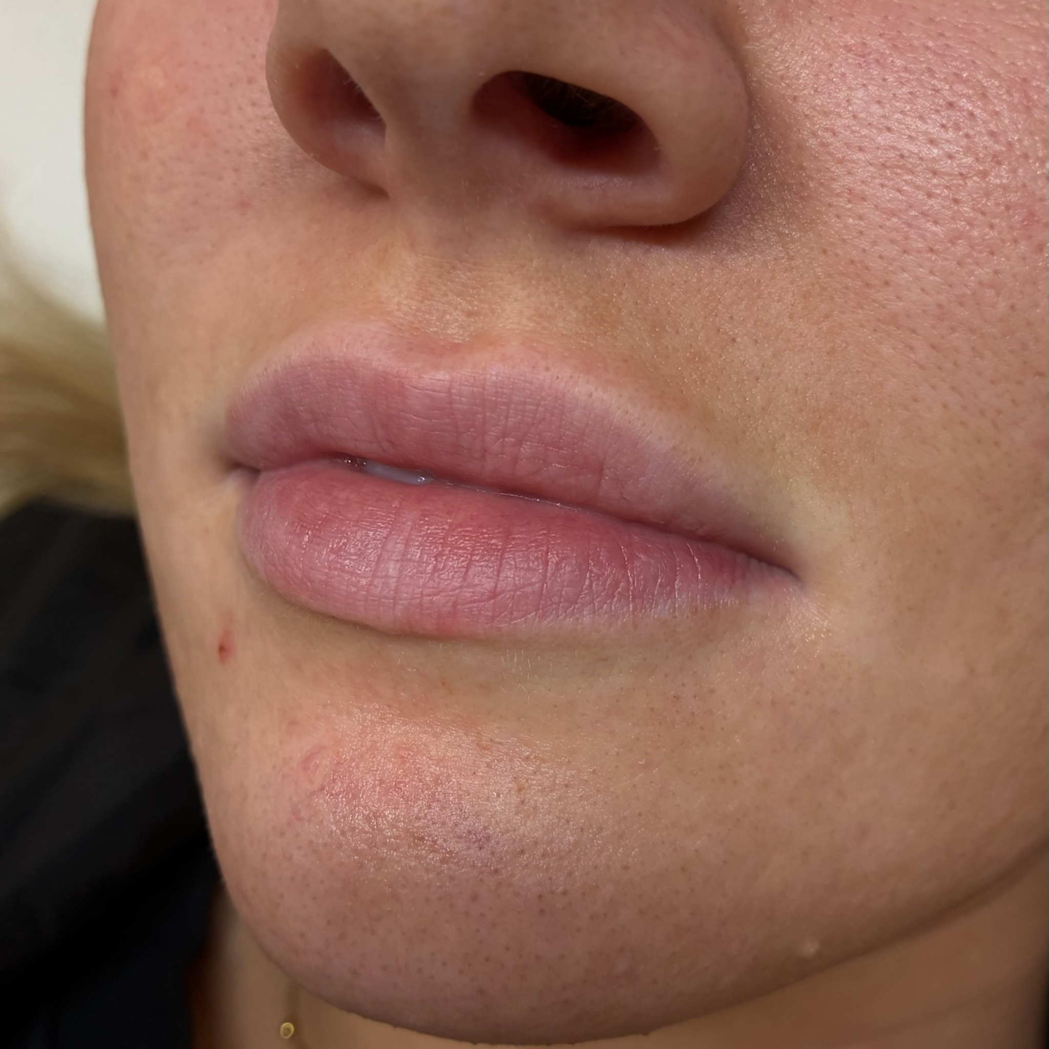 lips six left before