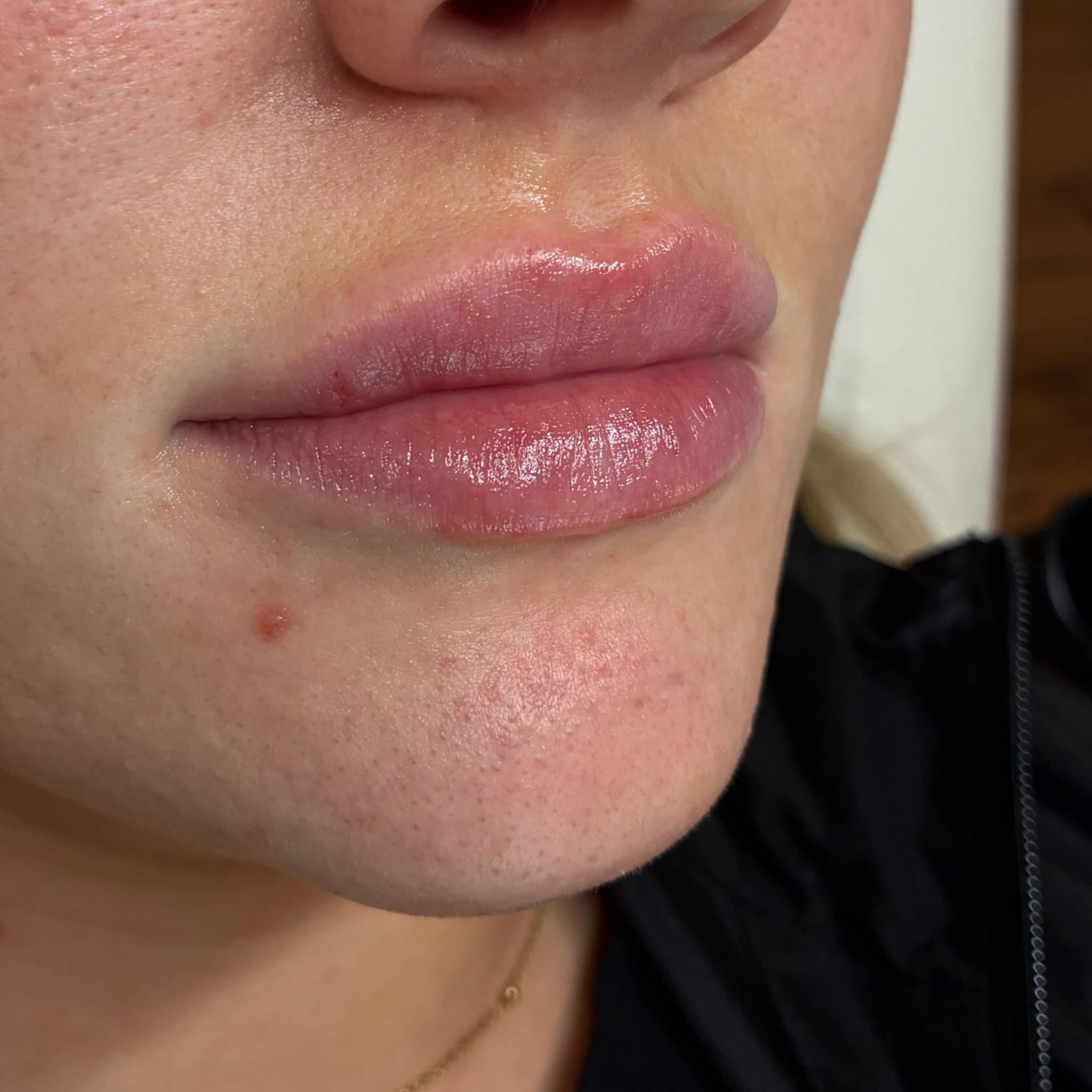 lips six right after
