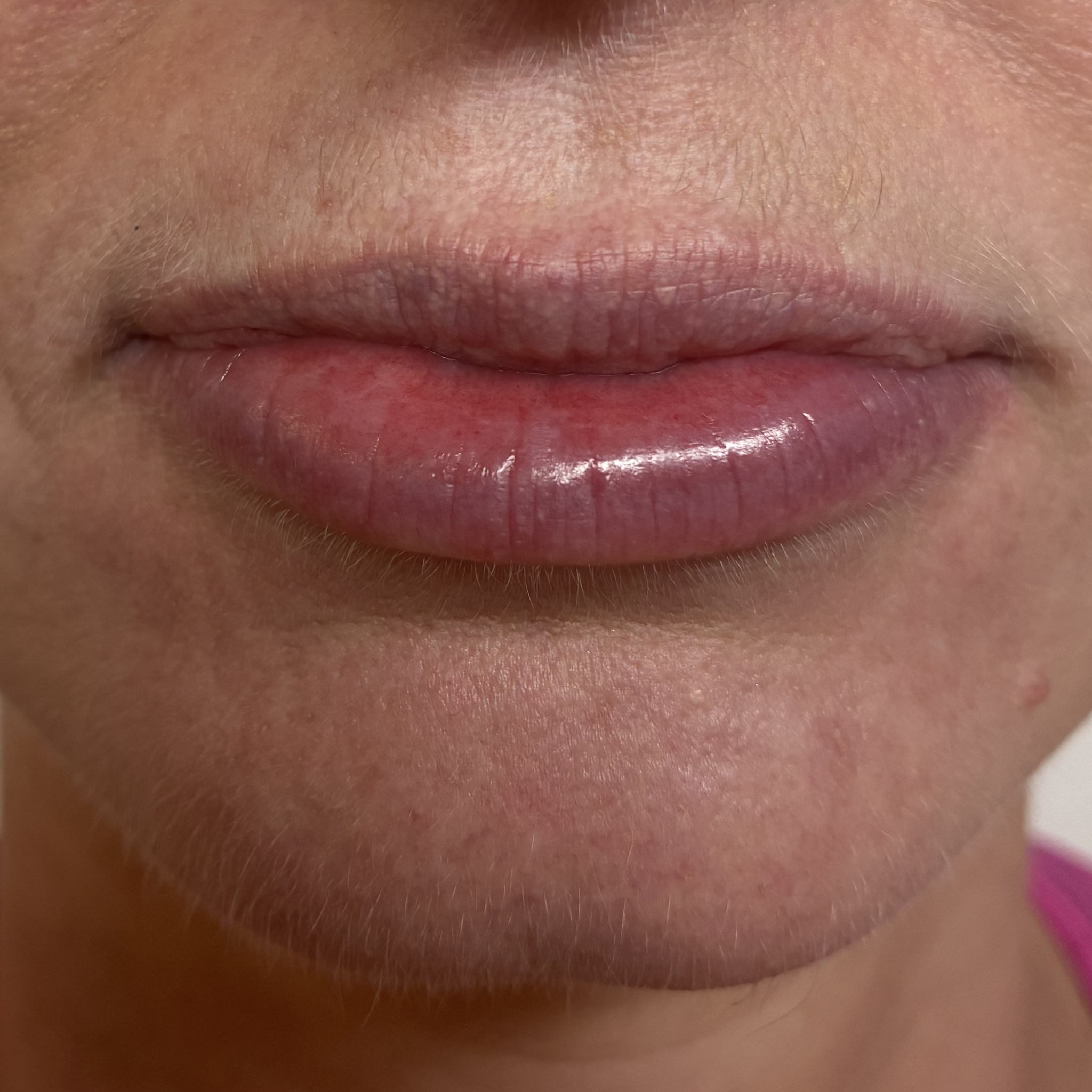 lips ten front before