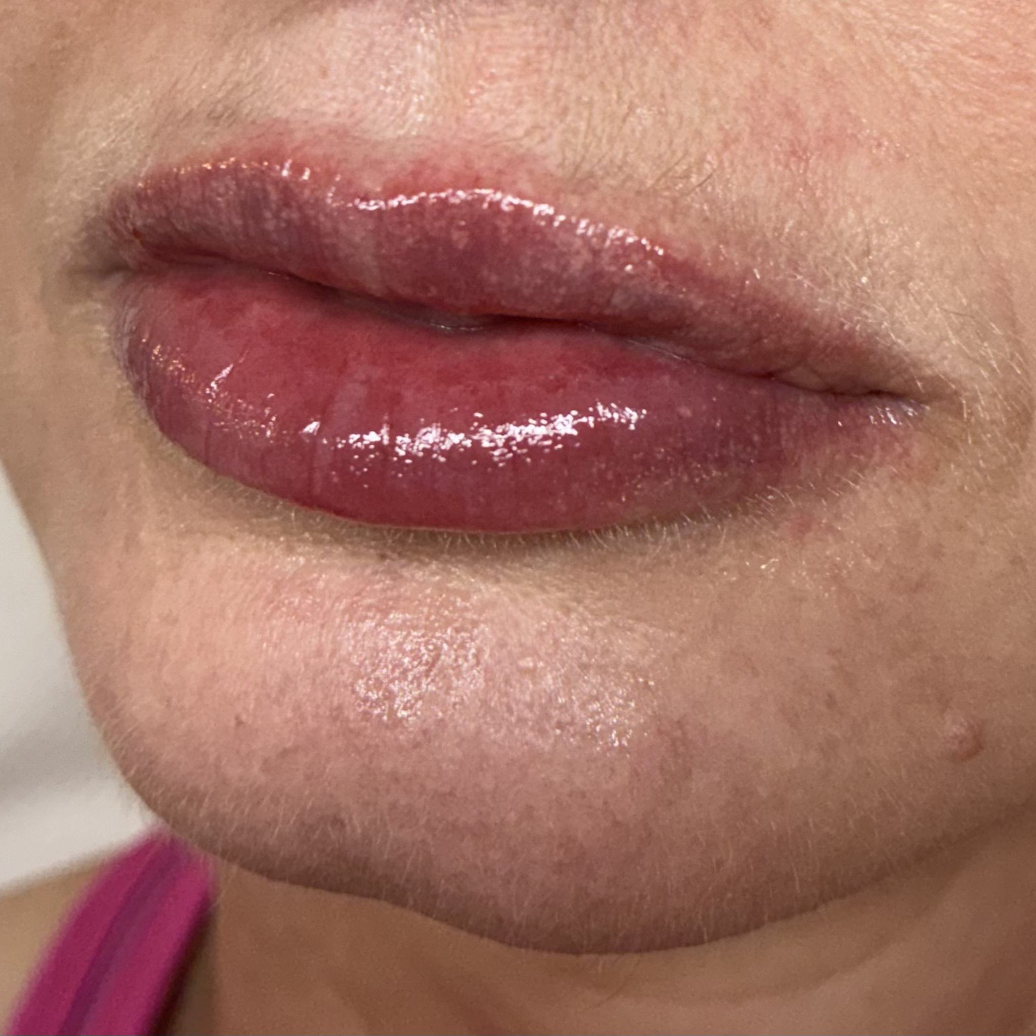 lips ten left after