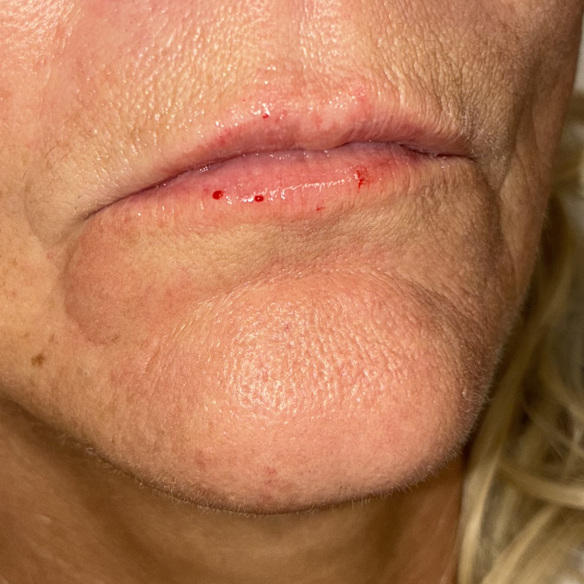 lips twelve right after