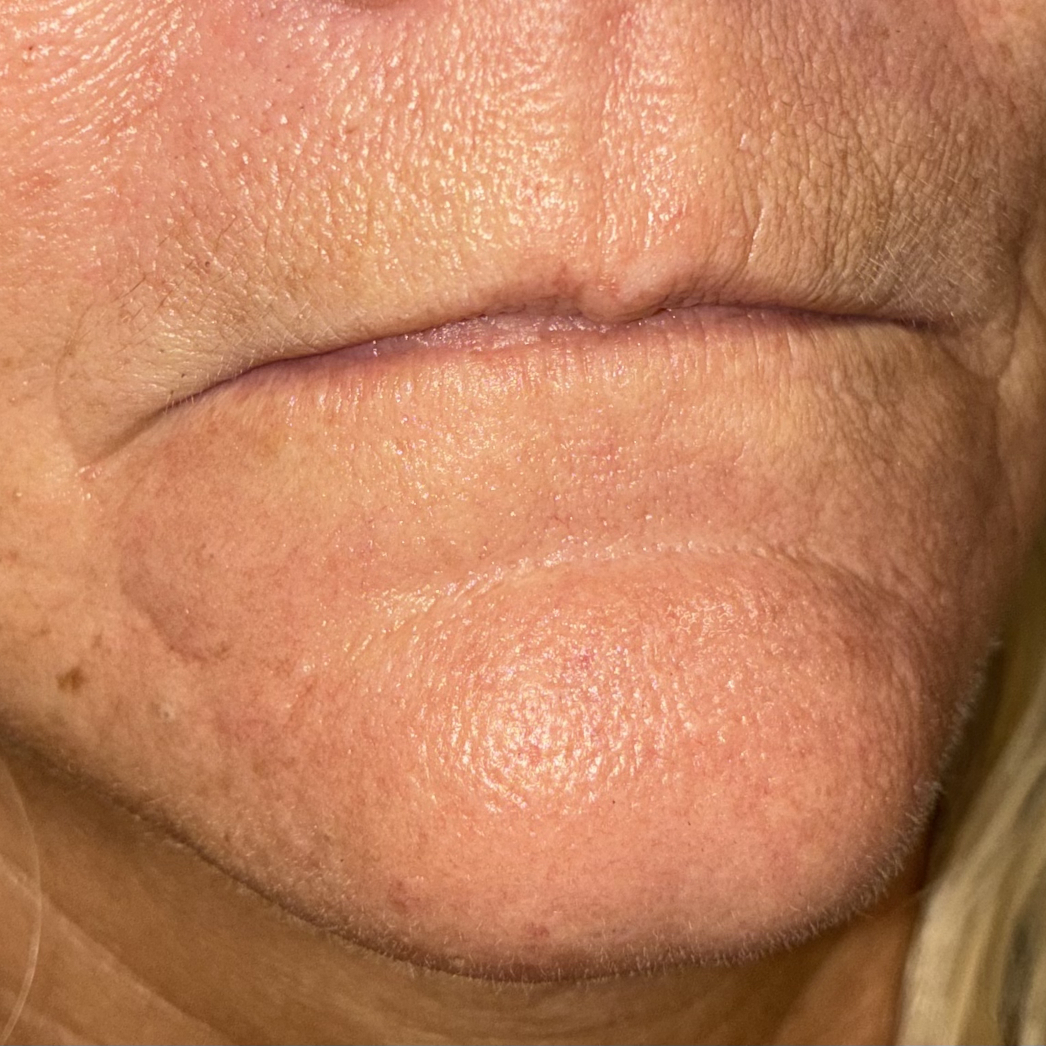 lips twelve right before