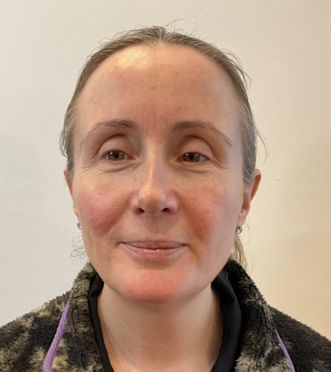 obagi skincare before