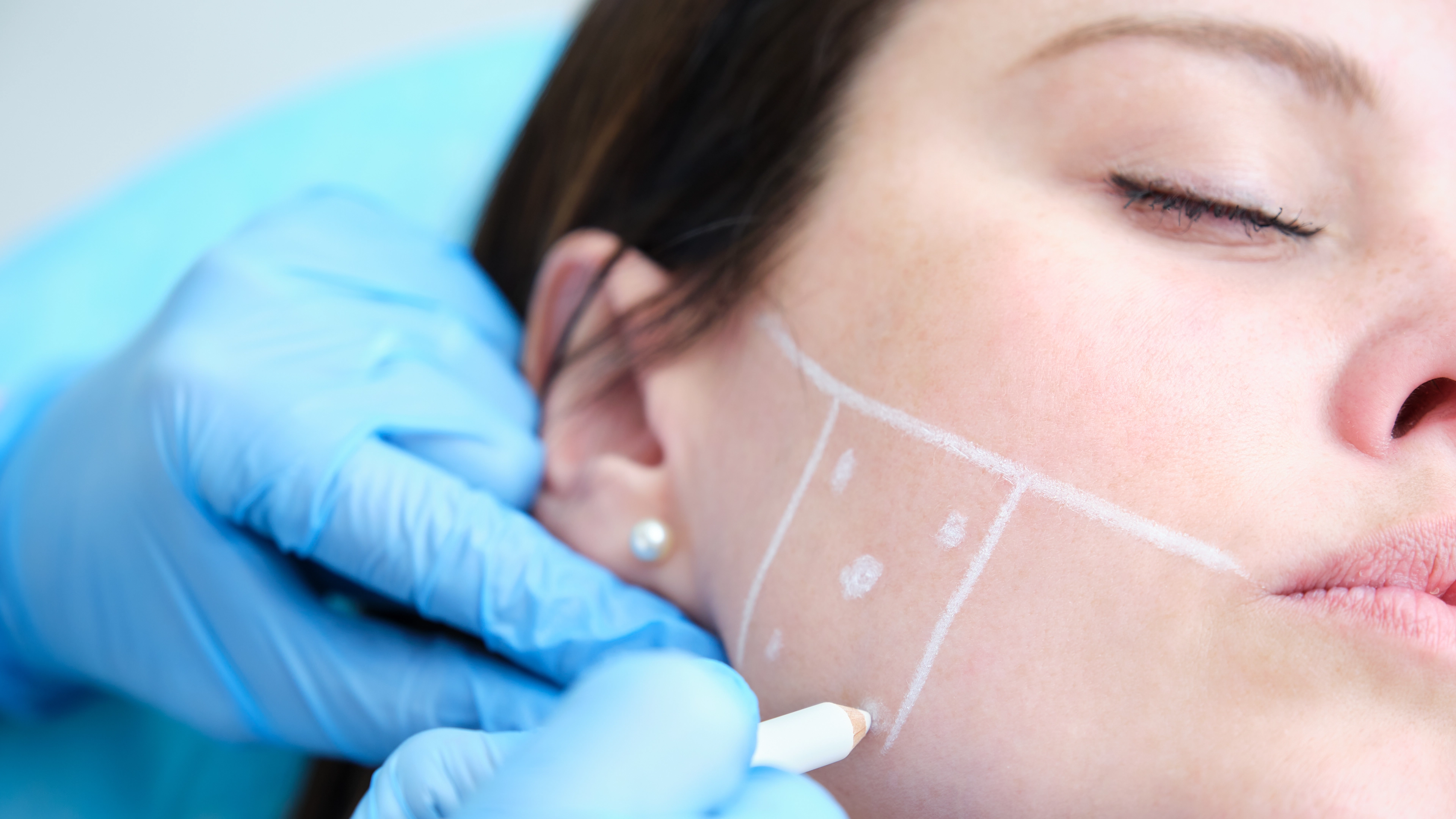 antiwrinkle injections image two
