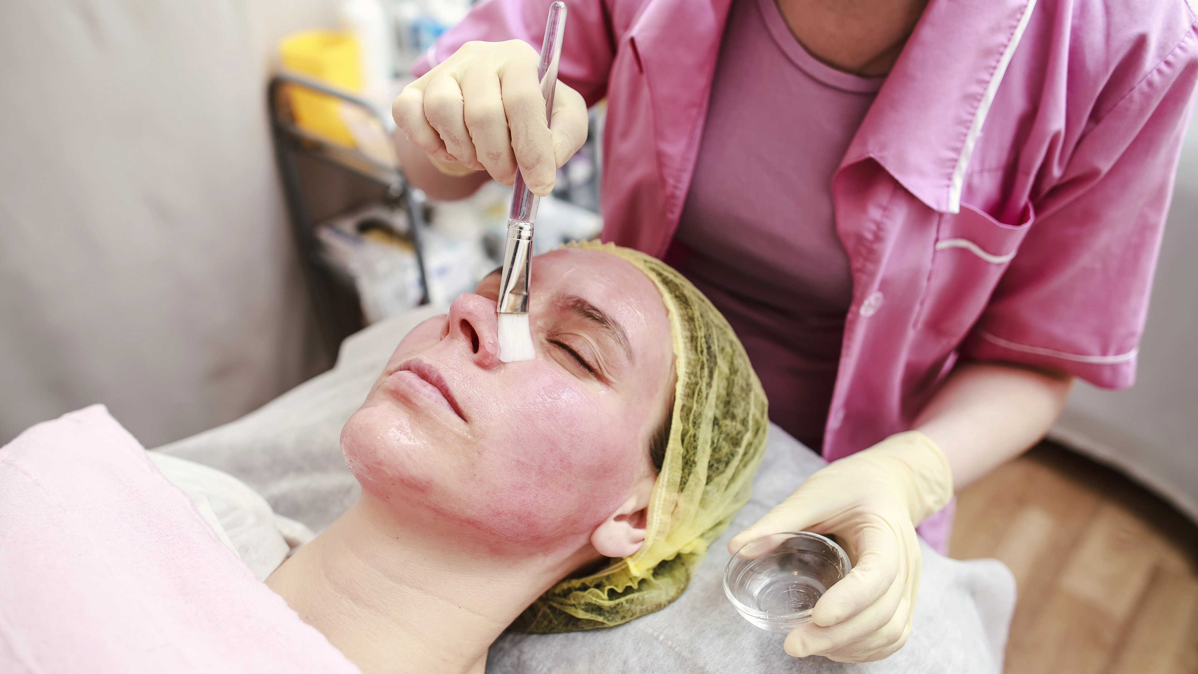 chemical peel two 4k