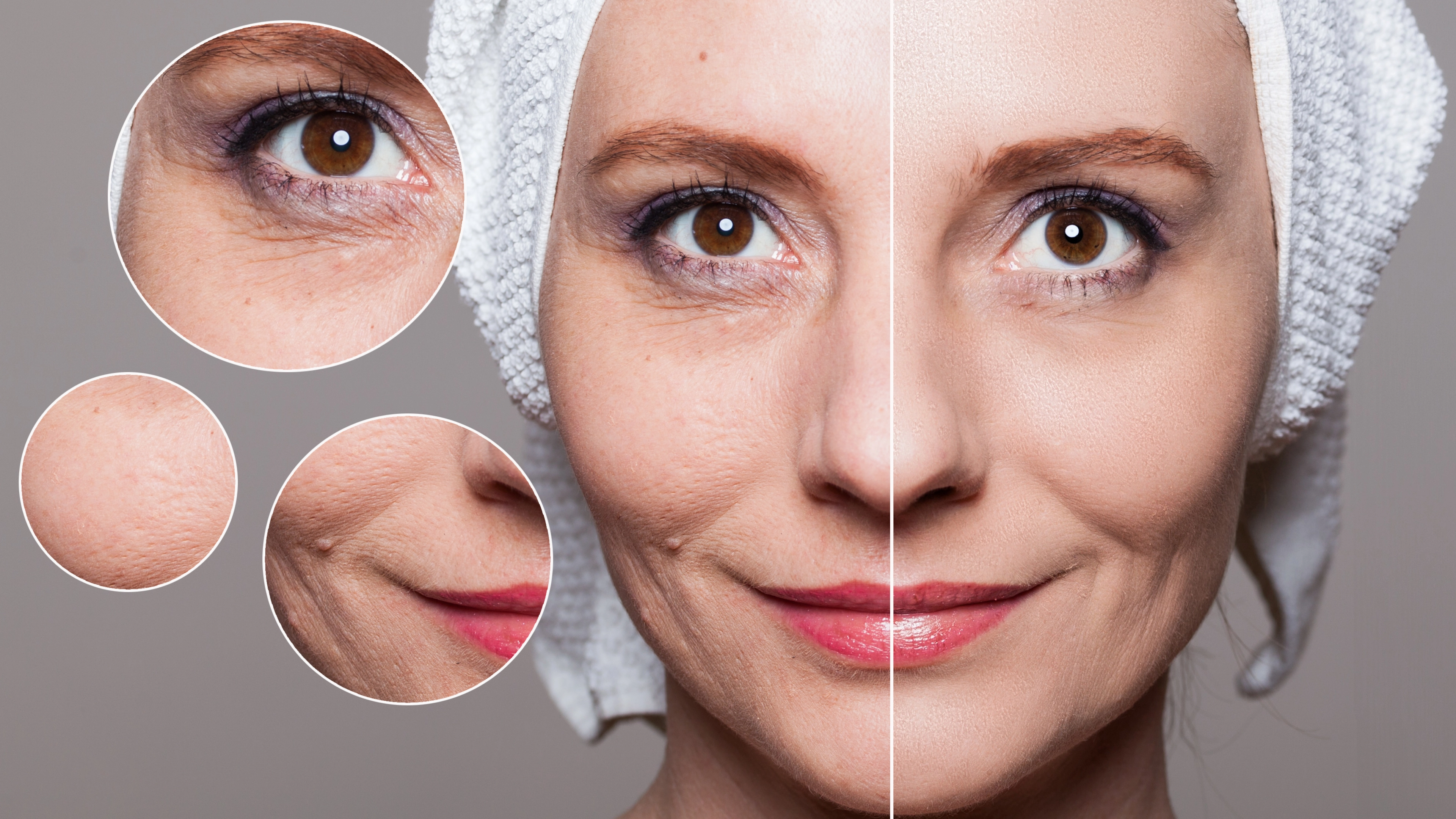 microneedling before and after